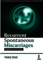 Recurrent Spontaneous Miscarriagesسقط های خود به خودی مکرر